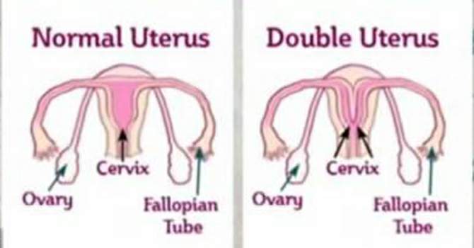 vagina-02.jpg